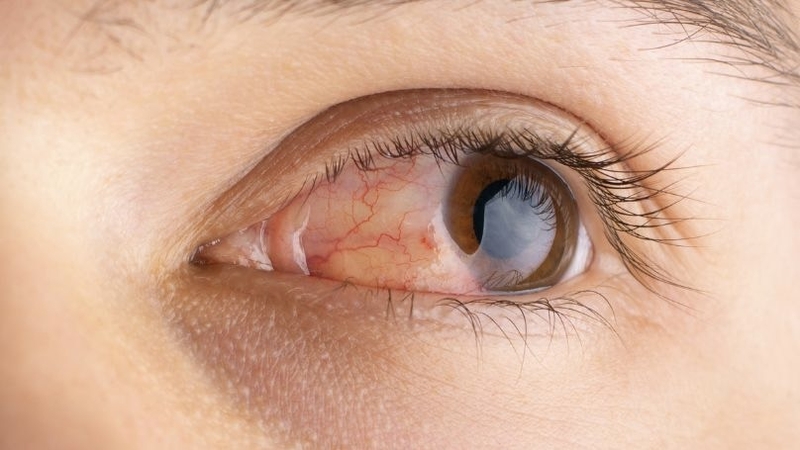 tang-nhan-ap-la-gi-chia-khoa-bao-ve-suc-khoe-doi-mat 3