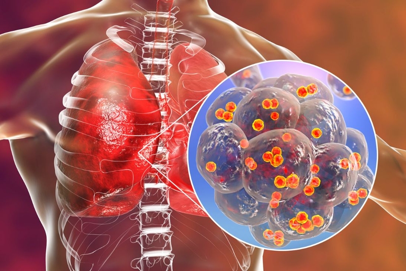 Tạng phế là gì? Tạng phế có chức năng gì? Triệu chứng bệnh ở tạng phế 3