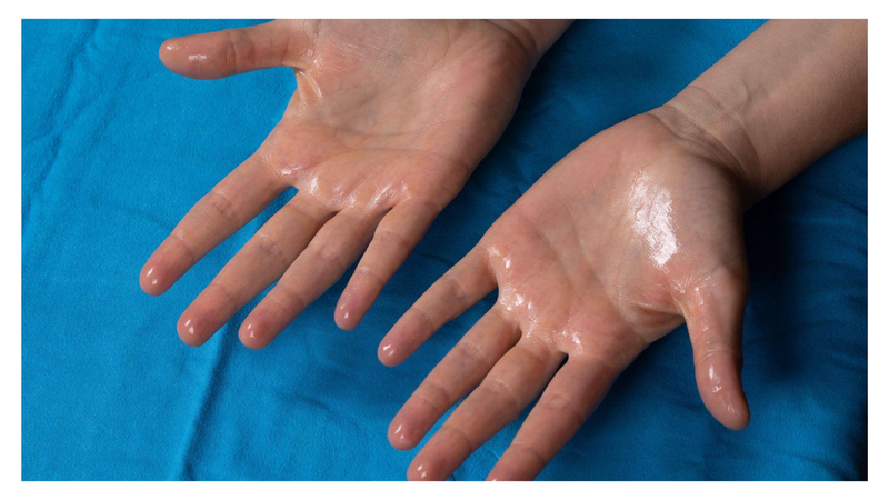 tang-tiet-mo-hoi-nguyen-nhan-va-bien-phap-khac-phuc 3.png