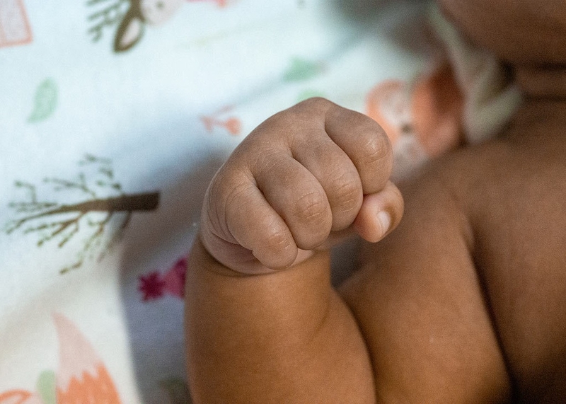 Tăng trương lực cơ ở trẻ: Nguyên nhân, triệu chứng và cách điều trị 3