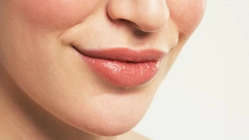 Tạo khoé miệng cười: Quy trình phẫu thuật, cách chăm sóc 1