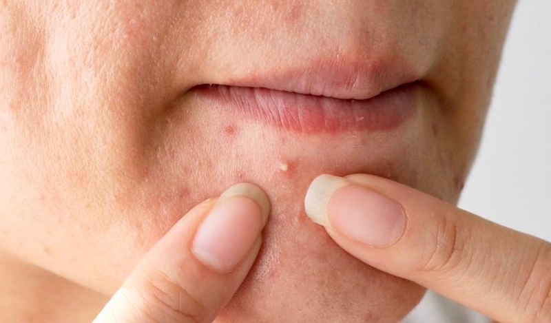 Tảo xoắn có tác dụng gì cho da mặt? Các công thức mặt nạ dưỡng da 2