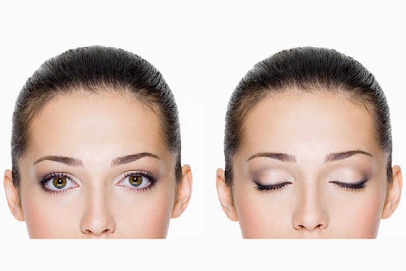 Giới thiệu về những cách hạ nhãn áp 3