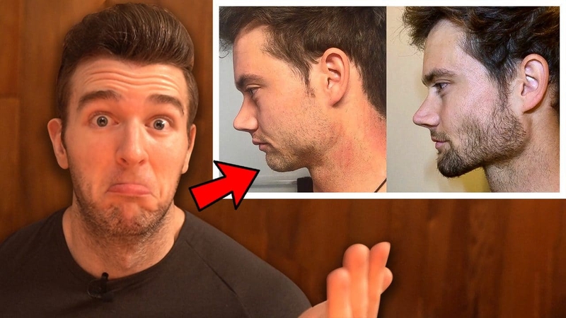 Tập Mewing có giúp mũi cao không hay chỉ là lời đồn?1