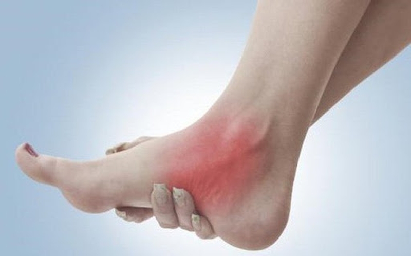 Những Cách Xử Lý Và Bài tập phục hồi bong gân cổ chân 2