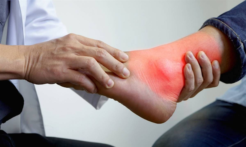 Các bài tập vật lý trị liệu bong gân cổ chân mà bạn nên biết 3