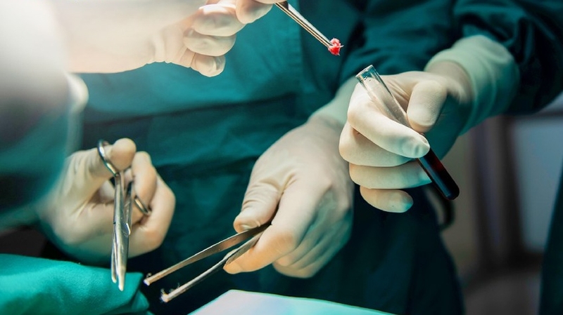 Tất cả những điều bạn cần biết về sinh thiết vú 6