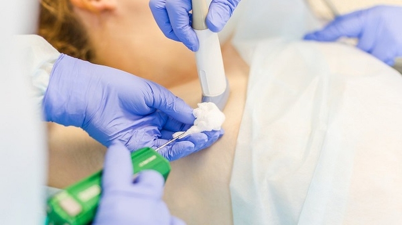 Tất cả những điều bạn cần biết về sinh thiết vú 7