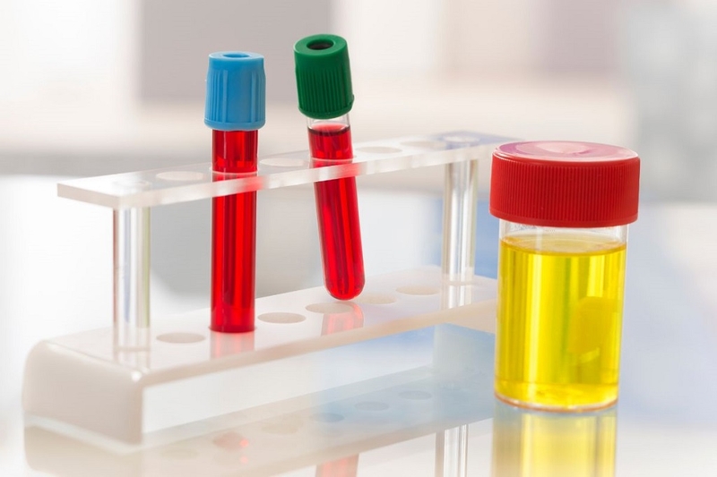 Tất tần tật những thông tin về chỉ số độ pH trong nước tiểu mà bạn cần phải biết 1