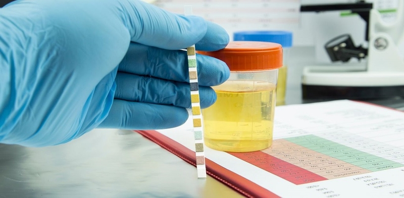 Tất tần tật những thông tin về chỉ số độ pH trong nước tiểu mà bạn cần phải biết 2