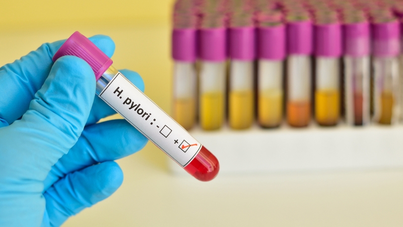 Tất tần tật về nhóm máu O: Cách xác định, nguy cơ bệnh và chế độ ăn phù hợp 4