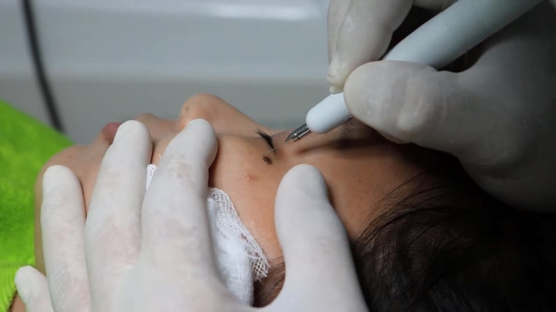 tay-not-ruoi-co-an-duoc-mi-tom-khong-nhung-thu-can-kieng-sau-khi-tay-not-ruoi 6