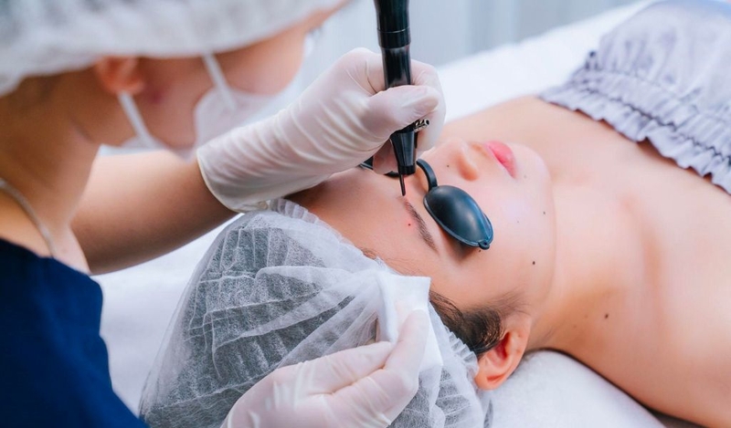 Tẩy nốt ruồi to và lồi có an toàn không? Cách khắc phục phổ biến? 2