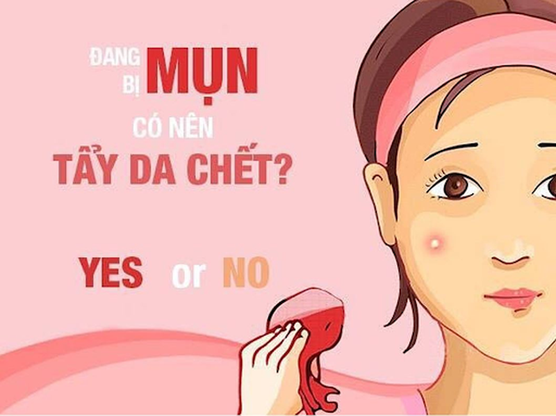 Tẩy tế bào chết cho da mụn sao cho đúng