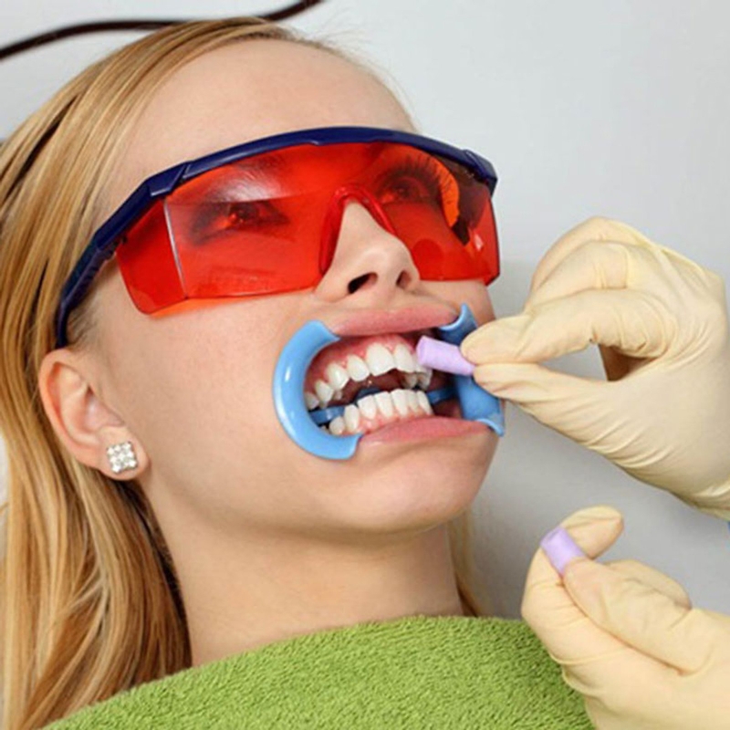 Tẩy trắng răng bằng đèn Plasma có thực sự tốt?-2