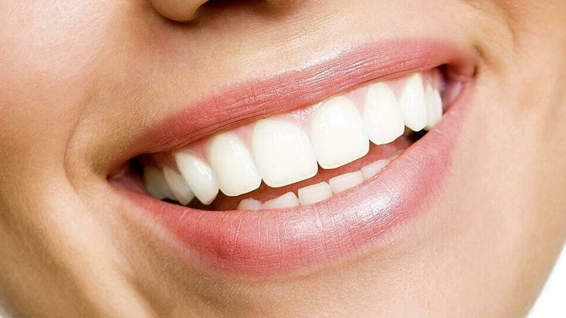 Tẩy trắng răng mất bao lâu thì đạt hiệu quả 2