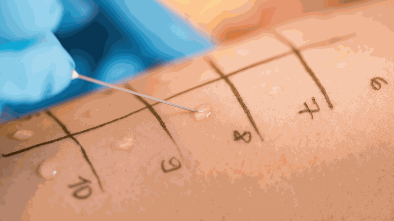 TB test là gì? Những thông tin cần biết 2