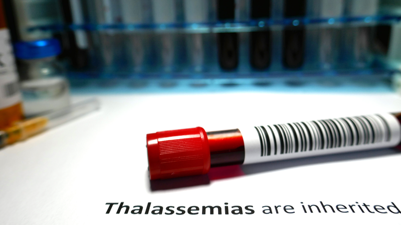 Điện di huyết sắc tố thường được chỉ định để chẩn đoán bệnh Thalassemia