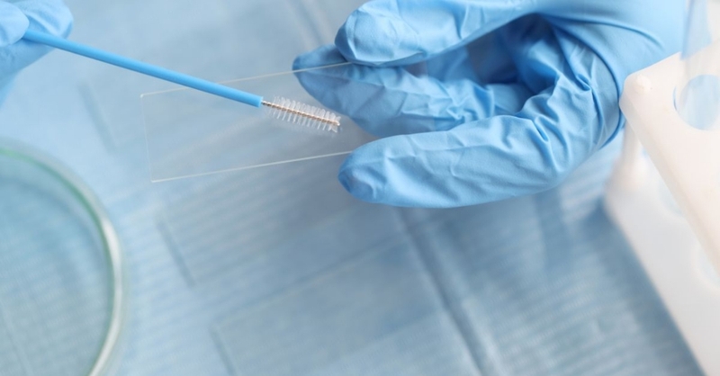 Tế bào ascus có nguy hiểm không? Làm gì khi xét nghiệm Pap có tế bào ascus? 4