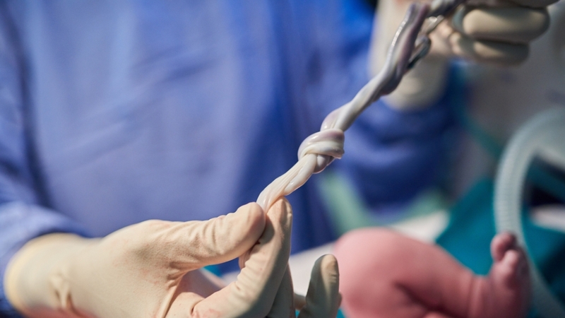 Tế bào gốc điều trị có thể lấy từ phôi, cuống rốn, mô trưởng thành