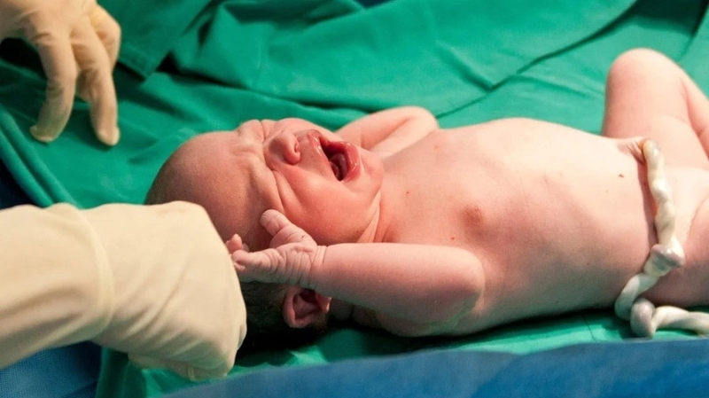 Tế bào gốc máu cuống rốn là gì? 2