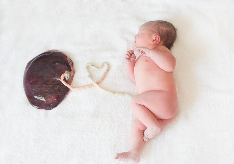 Tế bào gốc trung mô từ dây rốn: Nguồn gốc, ưu điểm và ứng dụng 1