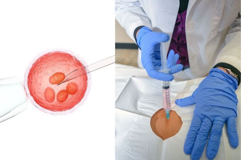 Tế bào gốc tự thân là gì? Ưu điểm của ghép tế bào gốc tự thân 2