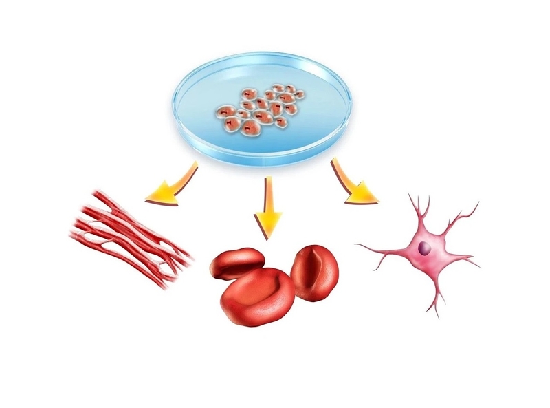 Tế bào gốc tự thân là gì? Ưu điểm của ghép tế bào gốc tự thân 1