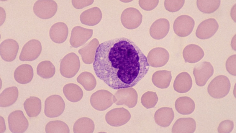 te-bao-khong-dien-hinh-la-gi-te-bao-khong-dien-hinh-co-phai-la-ung-thu 2.jpg