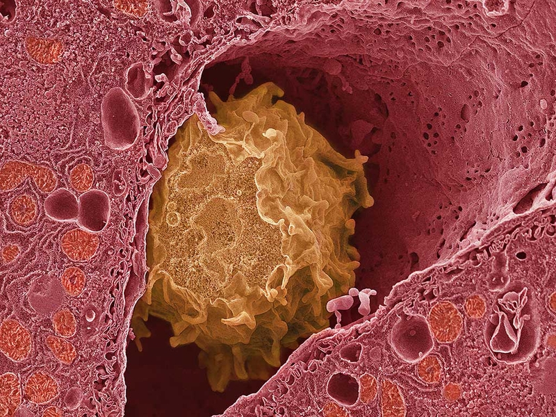 Tế bào kupffer là gì? Sự thật về thủ phạm gây ra các bệnh cho gan 1