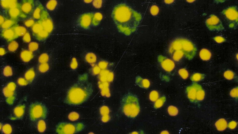 Các tế bào bị nhiễm virus sẽ mang kháng nguyên nội sinh trên bề mặt