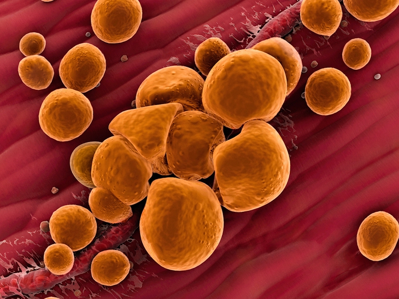 Tế bào mỡ và các hình dạng khác nhau trong cơ thể 4