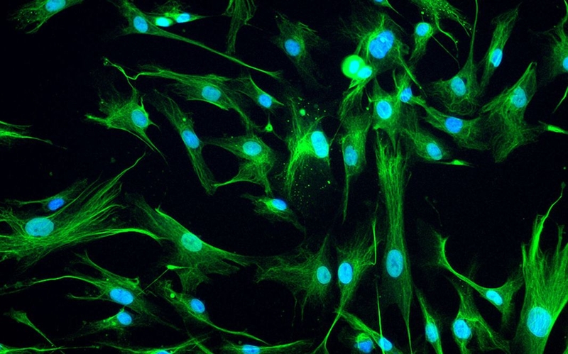 Tế bào Schwann là gì? Cấu trúc, chức năng và bệnh lý liên quan 2