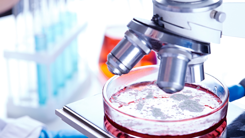 Tế bào T CD4 được phát hiện là yếu tố chính trong việc phòng ngừa bệnh lao 3