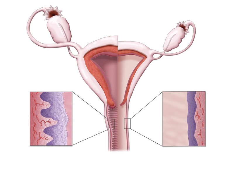 Teo âm đạo và những điều cần biết 1