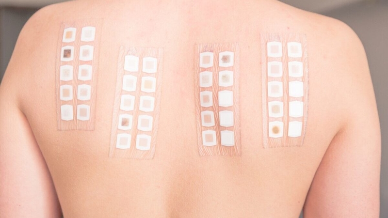 test-ap-bi-la-gi-dung-trong-truong-hop-nao 2.jpg