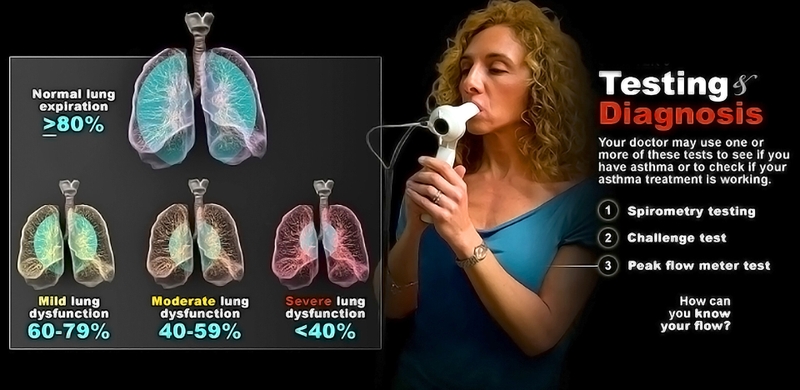 Test giãn phế quản có vai trò gì? Ai là đối tượng sử dụng? 2