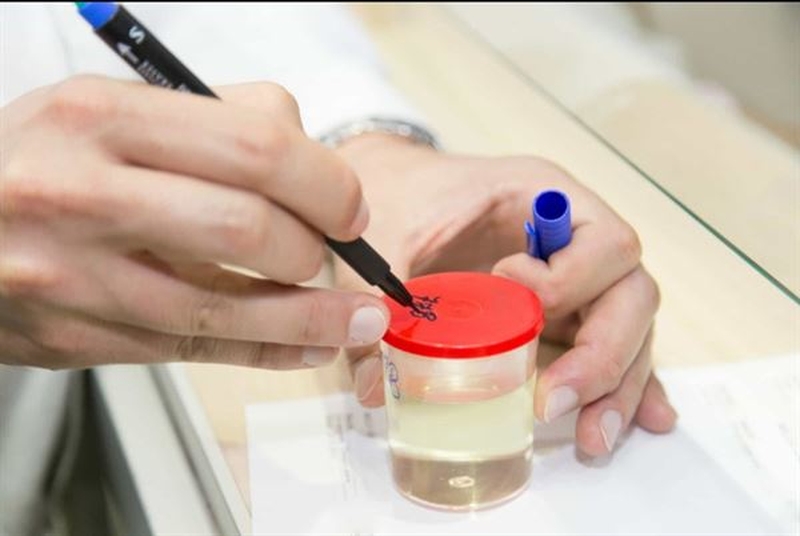 Các phương pháp để test rối loạn thần kinh thực vật 3