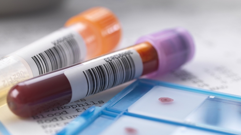 Test viêm gan B có những phương pháp phổ biến nào? 3