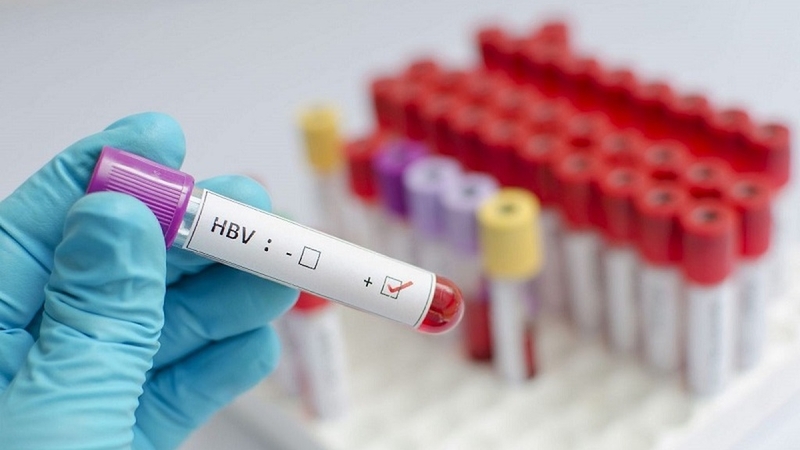 Test viêm gan B có những phương pháp phổ biến nào? 2
