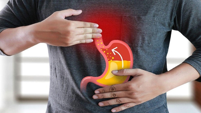 Thắc mắc: Bệnh trào ngược dạ dày có tự khỏi không? 8