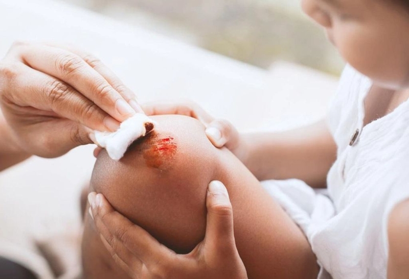 Thắc mắc: Bị vết thương hở ăn thịt vịt được không? 1