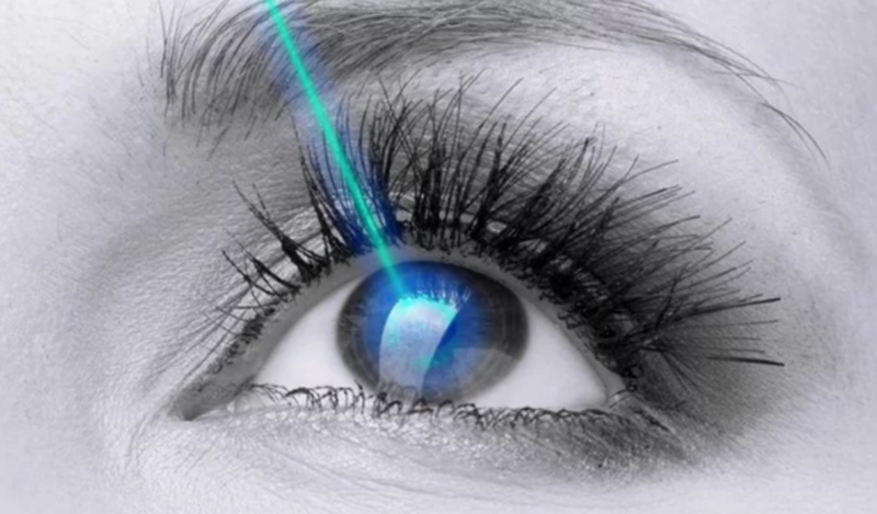 Bong võng mạc có mổ cận được không?