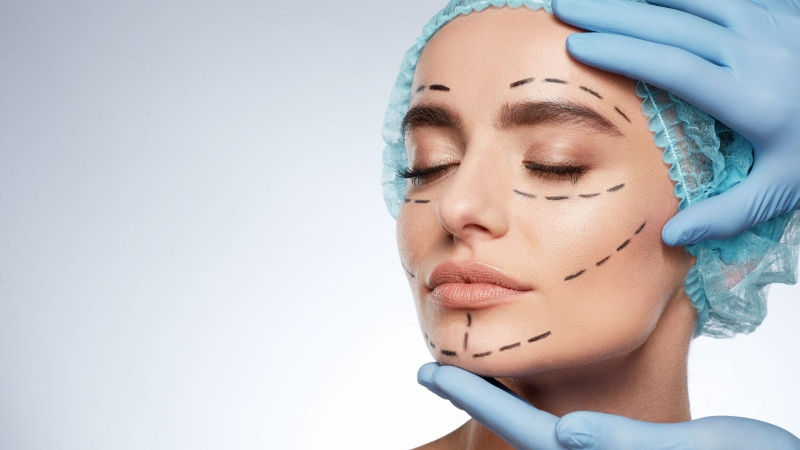 Thắc mắc: Độn cằm bao lâu thì tháo băng?2