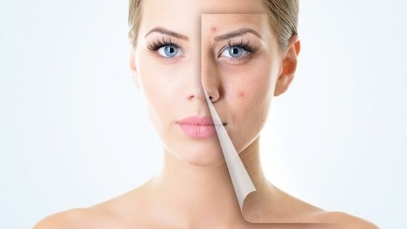 Thắc mắc: Dùng máy rửa mặt lên mụn có đúng không?  3