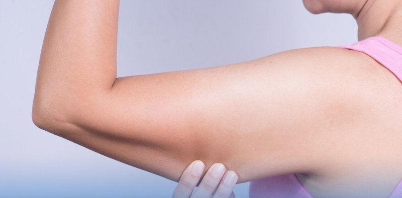 Thắc mắc: Hút mỡ bắp tay bao lâu thì lành và hết sưng?1