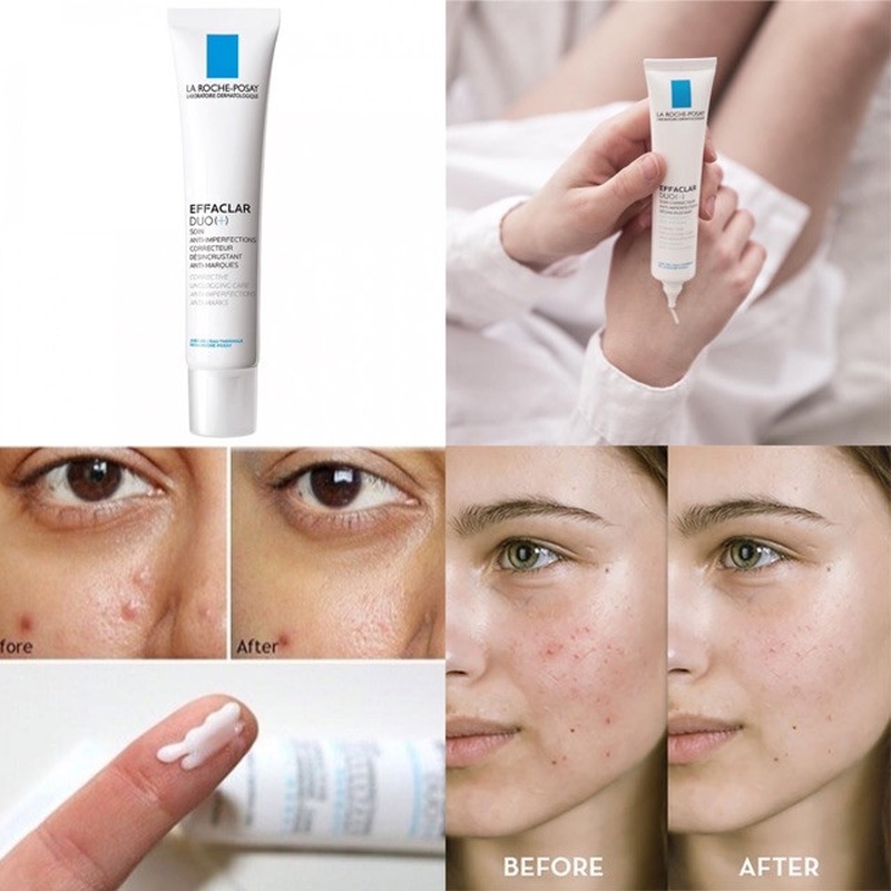 Thắc mắc: Kem trị thâm mụn La Roche Posay B5 có đẩy mụn không 3