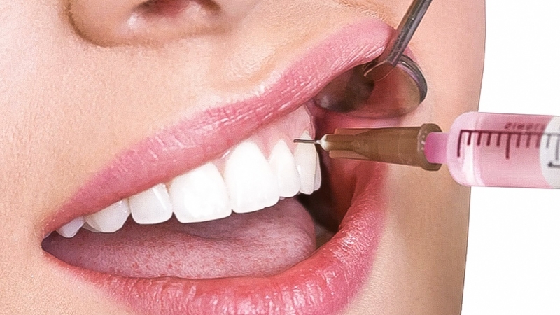 Thắc mắc lấy tủy răng có tiêm thuốc tê không 2