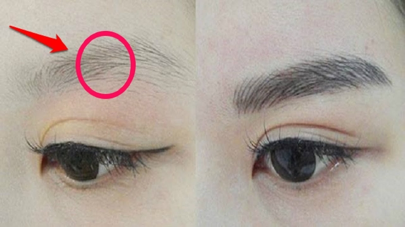 Thắc mắc: Lông mày có mọc lại không?1