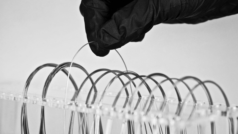 Thắc mắc niềng răng bao lâu thì thay dây cung 2